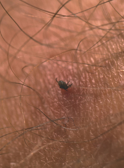 Karta do wyciągania kleszczy Lifesystems Tick Remover Card